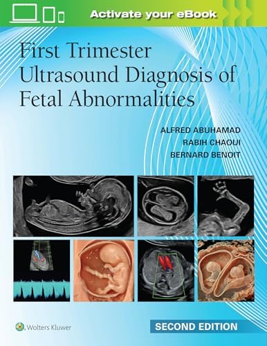 A Practical Guide to Fetal Echocardiography: Normal and Abnormal